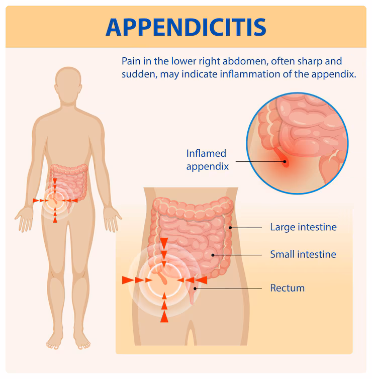  best appendix surgeon in kolar chintamani
