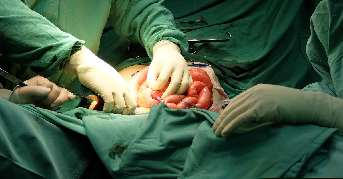 colectomy Hospital in Marathahalli