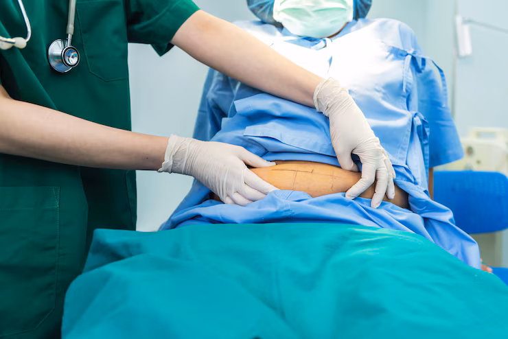 Endoscopic weight loss near Marathahalli
