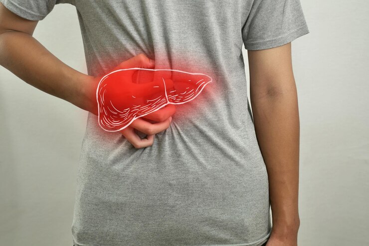 fundoplication surgery in Marathahalli

